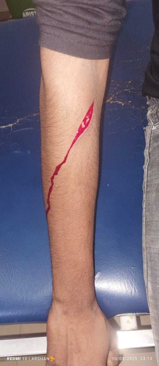 ಹಳೆ ಬಾಗಲಕೋಟೆಯಲ್ಲಿ ಯುವಕನಿಗೆ ಚಾಕು ಇರಿತ